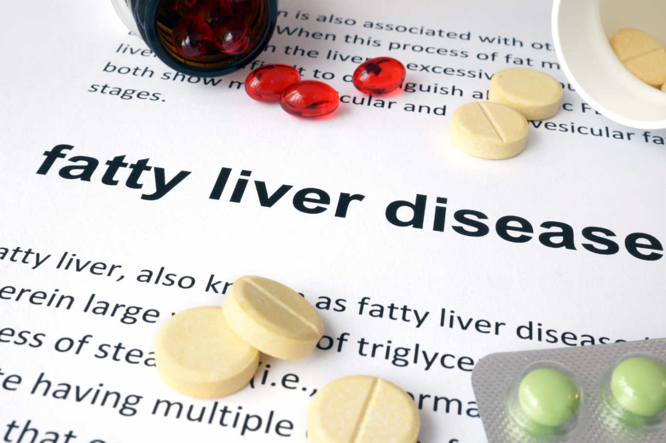11 Facts About Fatty Liver Disease