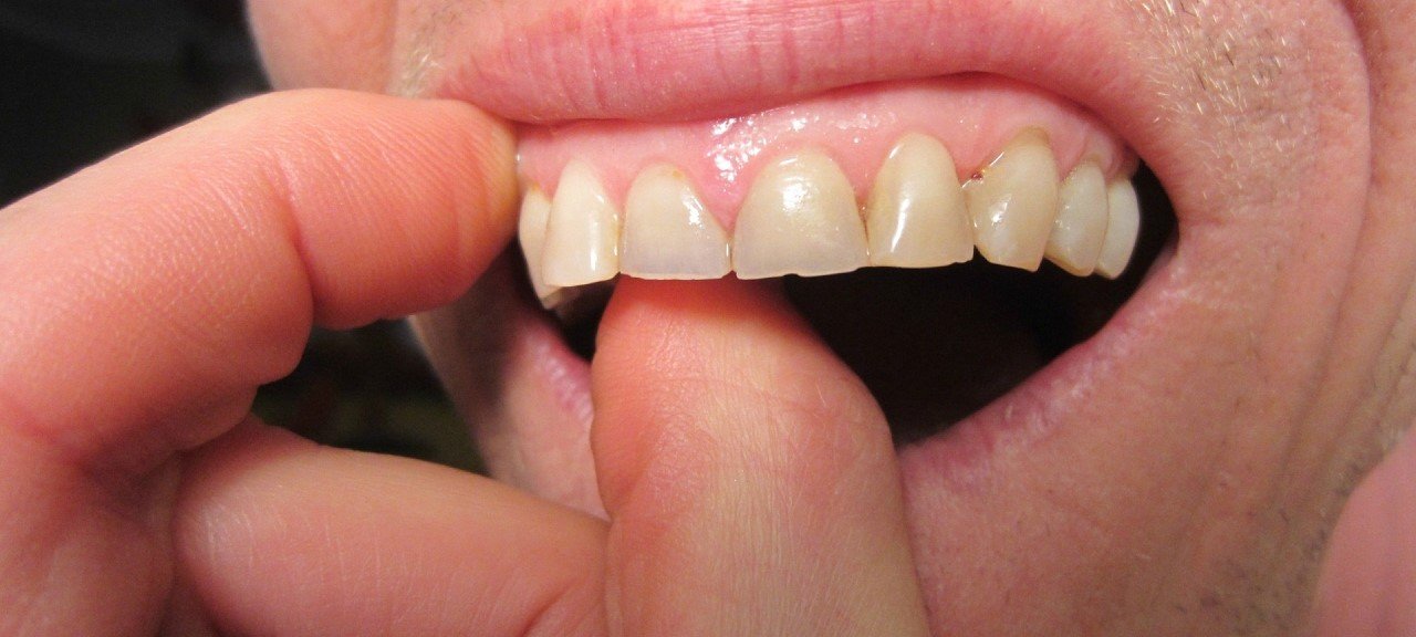 7 Steps to Strengthen Your Teeth and Gums Naturally Origin Of Idea