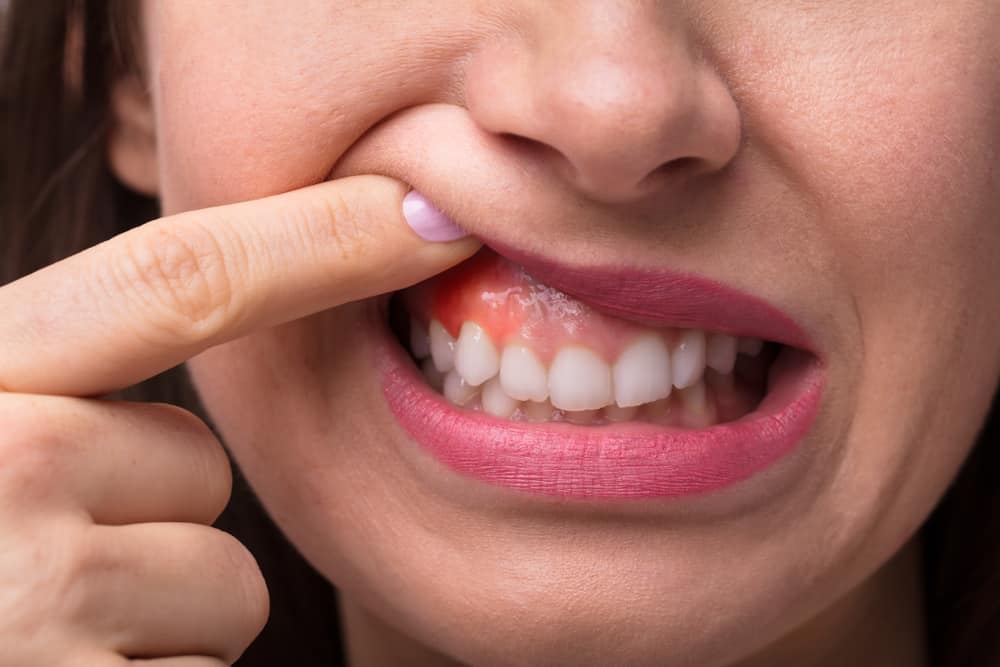 7 Steps to Strengthen Your Teeth and Gums Naturally